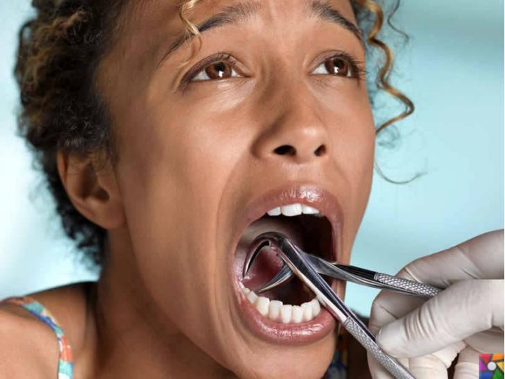İltihaplı diş çekilir mi? Apseli diş çekilirse ne olur? | Üniversite Hastaneleri çekilebilir diyor