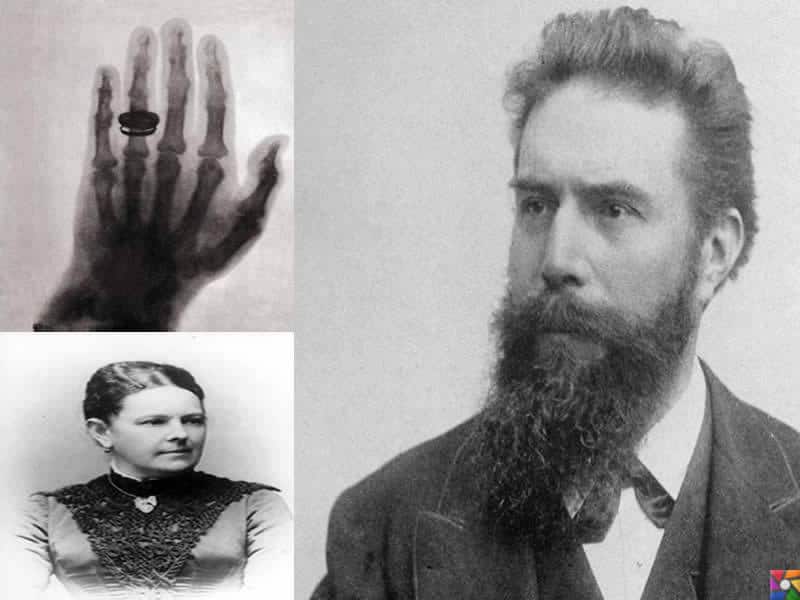 Wilhelm Conrad Röntgen Kimdir? | Eşinin ve ilk defa çekilen röntgen eşinin elinin fotoğrafları