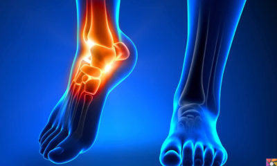 Ayak Bileği ağrısı nedir? Ayak Bileği neden ağrır? Tedavisi nedir?
