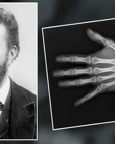 Wilhelm Conrad Röntgen Kimdir? Hayatı ve Biyografisi | Röntgenin Mucidi