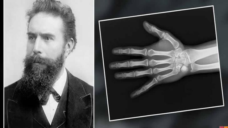 Wilhelm Conrad Röntgen Kimdir? Hayatı ve Biyografisi | Röntgenin Mucidi