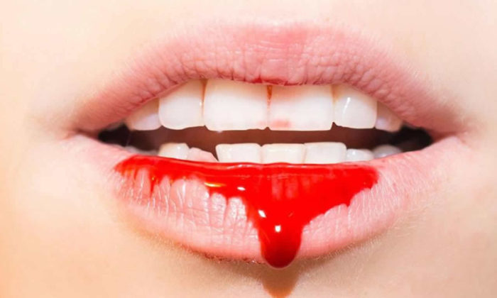 Kan içerek beslenen insanlar var mı? Vampir insanlar gerçek mi?