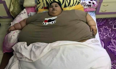Dünyanın en kilolu kadını mide ameliyatı oldu ve yaşamını yitirdi!