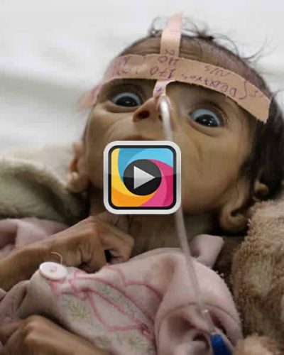 Unicef’in açıkladığı korkunç rakama göre 1,5 milyon çocuk açlıktan ölecek