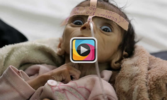Unicef’in açıkladığı korkunç rakama göre 1,5 milyon çocuk açlıktan ölecek