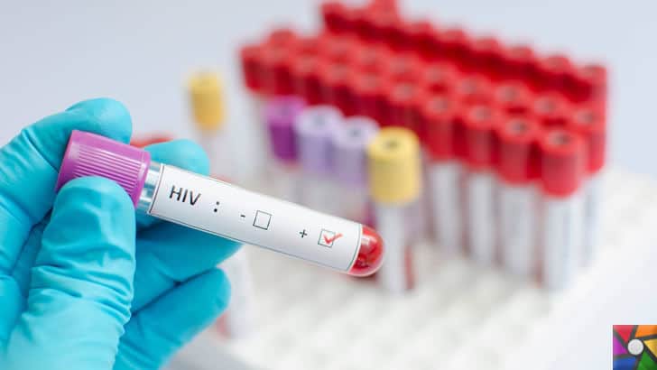 HIV virüsü nedir? HIV virüslü kişi ne kadar yaşar? | Elisa testi ile HIV virüsü anlaşılabilir