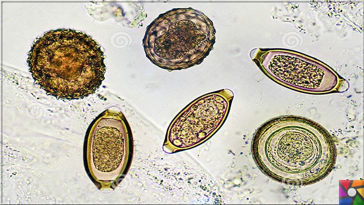 Parazit nedir? Parazitler nasıl oluşur? Parazitlerden Nasıl kurtulabiliriz? | Parazit yumurtaları