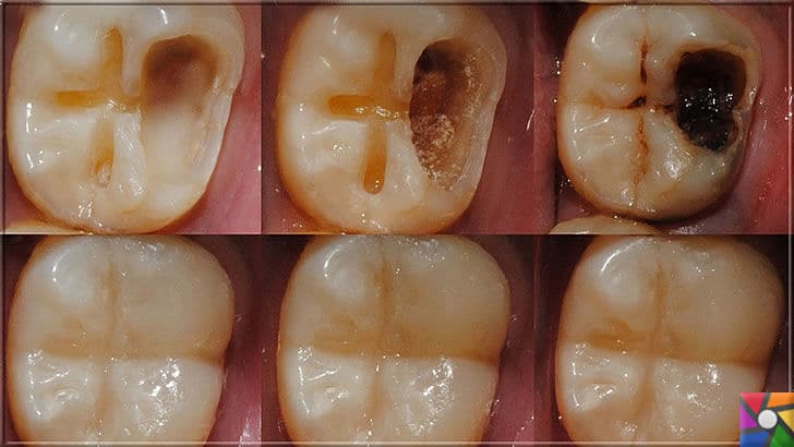 Ağız ve Diş sağlığı için misvak kullanmanın 8 bilimsel nedeni | Diş çürüklerini engellemek için diş plaklarını engellemek gerekir