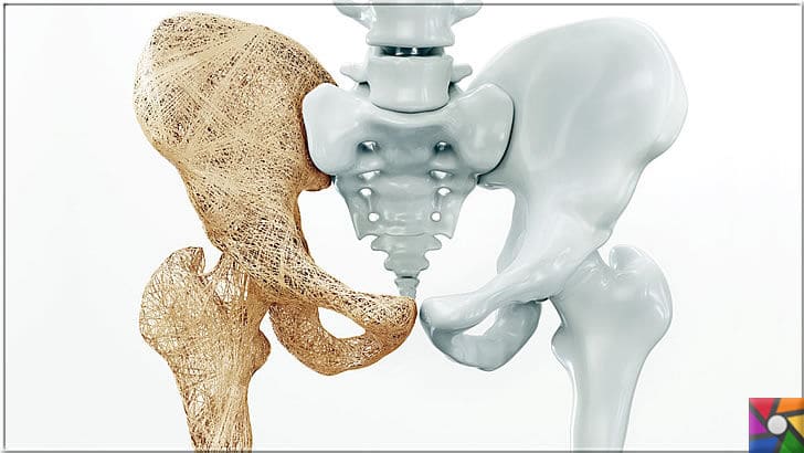 Kemik erimesi nedir? Kemik erimesinin nedeni Bağışıklık Sistemi mi? | Kemik erimesi sonrası, yaşlılarda en zorlu süreç, düşmelerde kalça kemiğini kırmasıdır