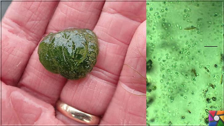 Dünyayı yaşanabilir hale getiren hayat kaynağı oksijen nasıl oluştu? | Siyanobakteri (Cyanobacteria) ile başka bir gezegende oksijen yapılabilecek mi?