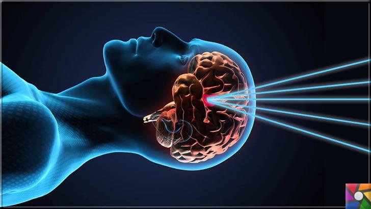 Gamma Knife Nedir? Gamma Knife Neden ve Nasıl Kullanılır?