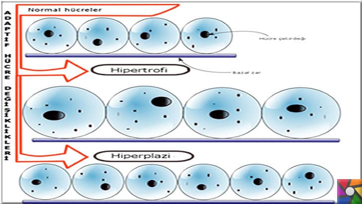 Yüksek kan şekeri ve yüksek insülin hormonunun bilinmeyen 9 zararı | Hiperplazi sürecinde hücrelerin çoğalması