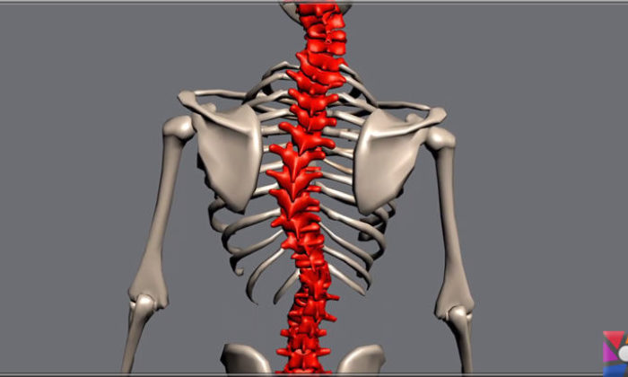 Skolyoz (Omurga eğriliği) nedir? Skolyoz tedavisi nasıl yapılır?