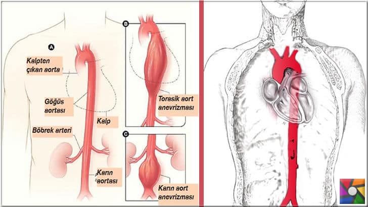Aort, insan vücudundaki en büyük atardamardır. 