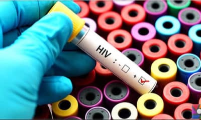 AIDS tedavisi için üretilen antikor başarılı oldu