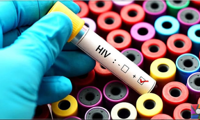 AIDS tedavisi için üretilen antikor başarılı oldu